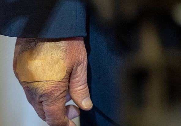 L'ecchymose à la main de Trump due à un choc contre une table