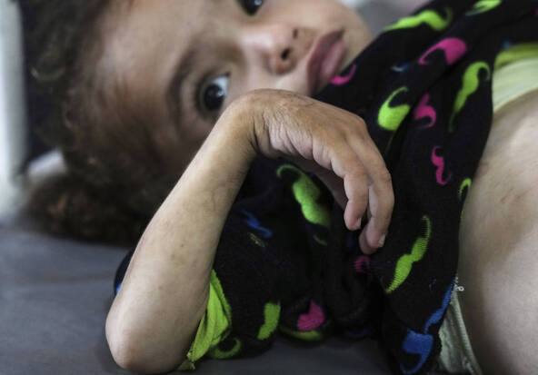 MSF alerte sur des niveaux de malnutrition dans ses hôpitaux à Gaza