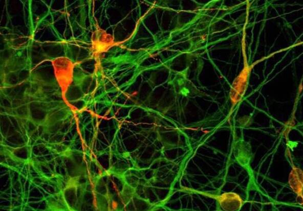 De minuscules blocs de cerveau créés en laboratoires