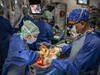 Swisstransplant met fin à son registre national des dons d'organes