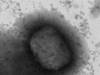 Troisième cas de variole du singe confirmé en Suisse