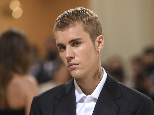 Justin Bieber souffre d'une paralysie au visage