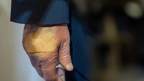 L'ecchymose à la main de Trump due à un choc contre une table