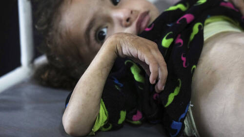 MSF alerte sur des niveaux de malnutrition dans ses hôpitaux à Gaza