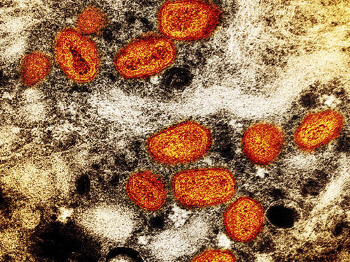 Variole du singe: l'OMS déplore des attaques contre des primates