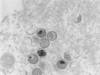 Pas de pandémie avec la variole du singe, selon un infectiologue