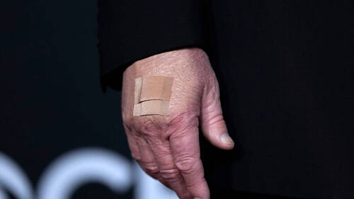 Trump arbore à nouveau un pansement: poignées de main pointées