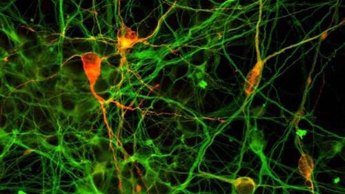De minuscules blocs de cerveau créés en laboratoires