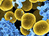 Les infections bactériennes, deuxième cause de décès dans le monde