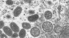video Un premier cas de variole du singe à Genève