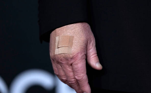 Trump arbore à nouveau un pansement: poignées de main pointées