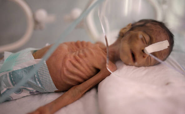 Les progrès s'essoufflent face à la mortalité infantile (ONU)