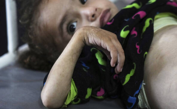 MSF alerte sur des niveaux de malnutrition dans ses hôpitaux à Gaza