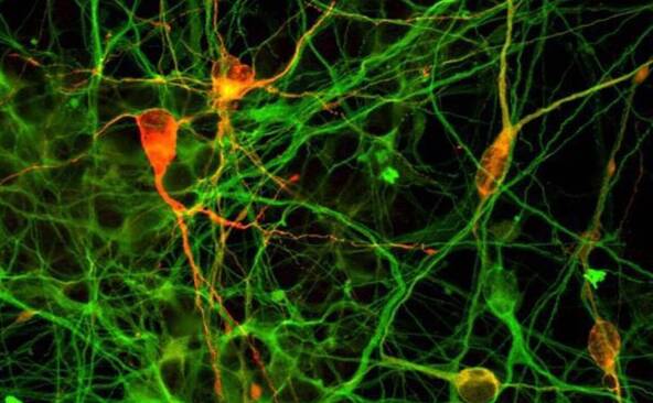 De minuscules blocs de cerveau créés en laboratoires